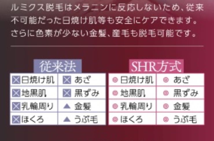 SHR方式について